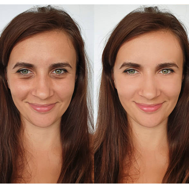 Before and After